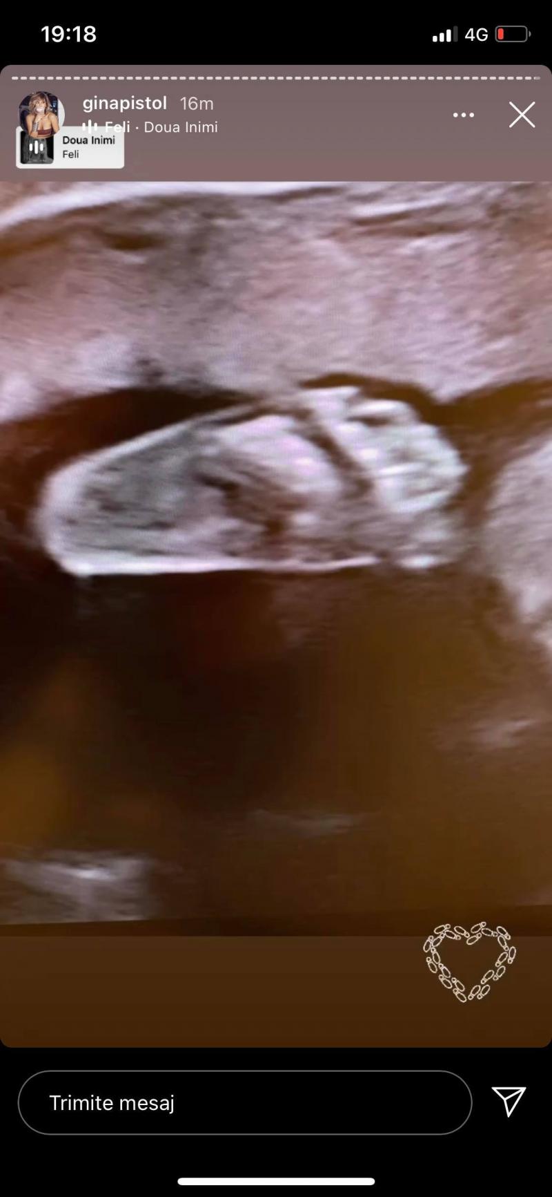 Gina Pistol a arătat ecografia bebelușului ei. Ce mesaj emoționant însoțește imaginea cu fetița