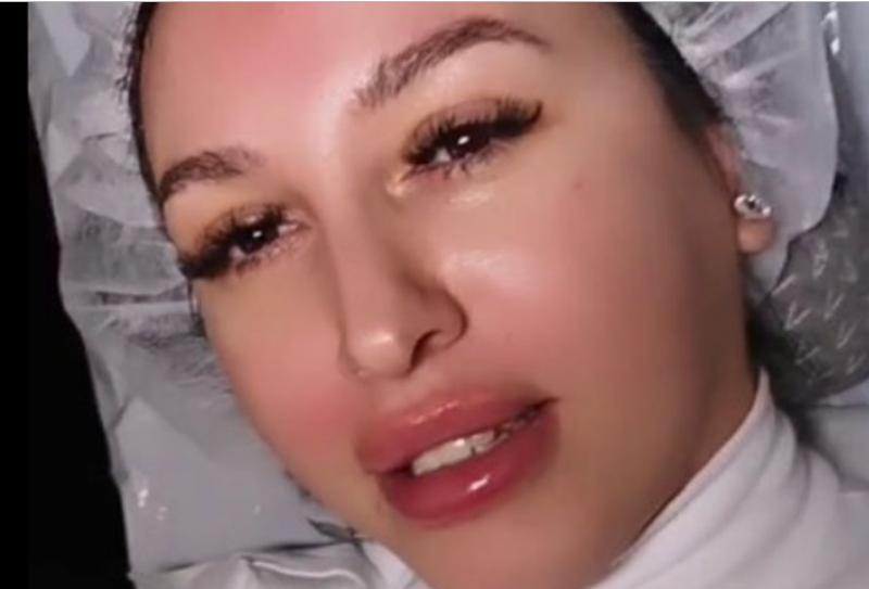 Mirela Baniaș, transformată TOTAL de intervențiile estetice! Nu mai arată deloc ca la „Insula Iubirii”! Ce a putut să își facă la față! FOTO