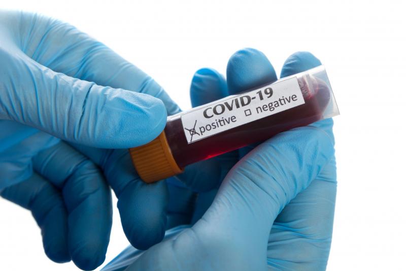 COVID-19 pozitiv? Tot ce trebuie să ştii dacă ai luat coronavirus. Dacă ai aceste simptome, consultă imediat un medic