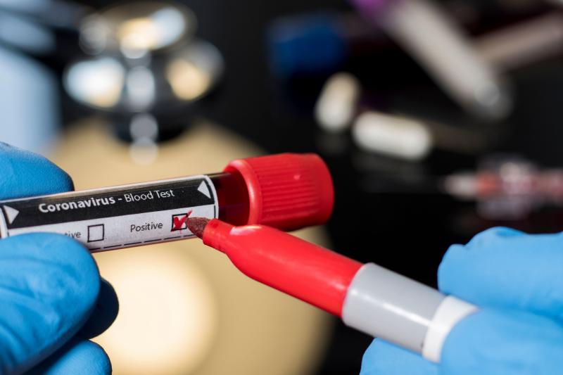 Coronavirusul, în cifre. Ce categorii de oameni ar trebui, de fapt, să se sperie de virusul ce face prăpăd în lume