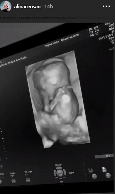 Alina Ceușan este însărcinată! Fosta concurentă de la Asia Express a postat o serie de imagini cu bebelușul | Video