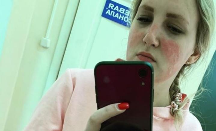 „Nu faceți această greșeală, cu masca de protecție! Mi-a distrus fața!”. O asistentă medicală, avertisment pentru toată lumea! FOTO