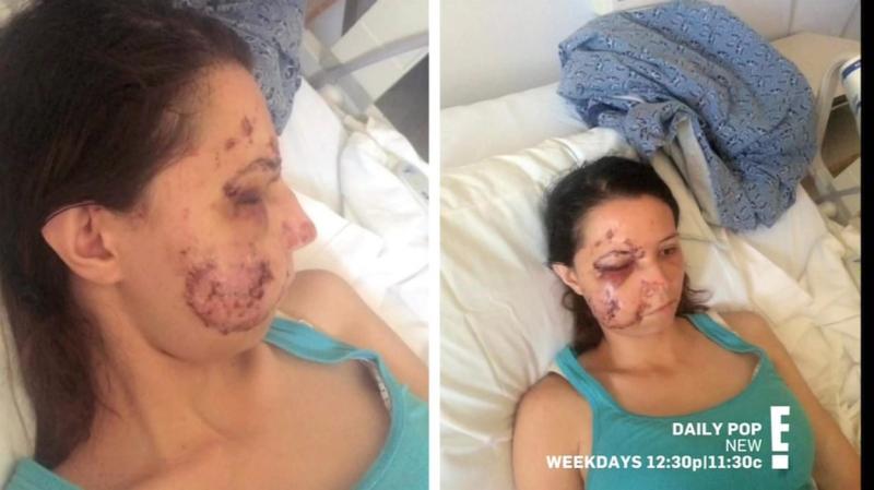 Tânără desfigurată în urma unui accident rutier: ”Medicii m-au lăsat ore în șir să sângerez, având cioburi în față!” Cum arată acum, după o operație de reconstrucție facială”