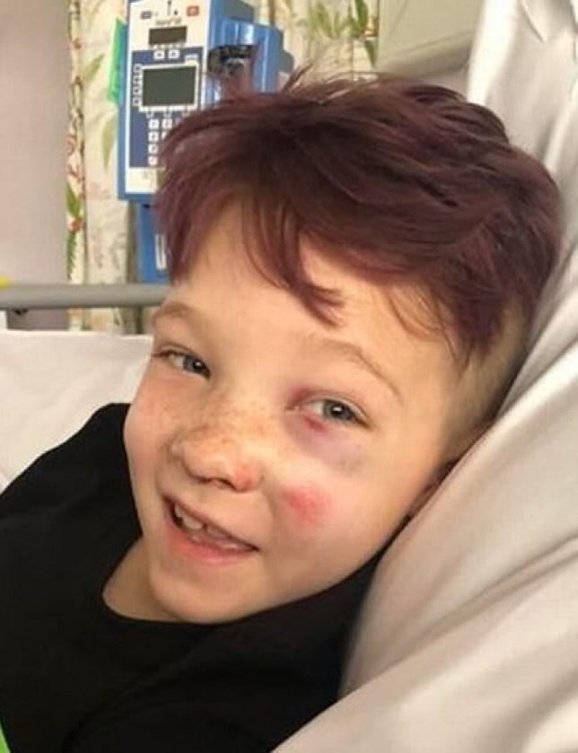 Aripi frânte la doar nouă ani! Un băiețel care iubea dansul și gimnastica și-a pierdut piciorul în urma unui accident: ”E hotărât să revină la pasiunile lui!”