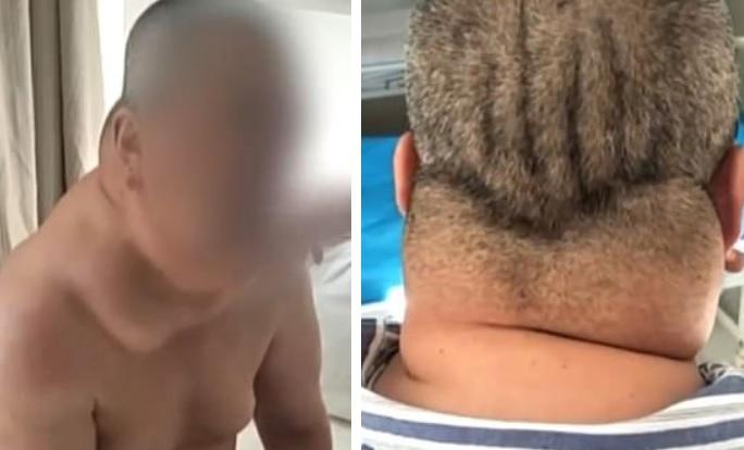 A băut un pahar cu tărie, în fiecare zi, timp de 40 de ani! Ce s-a întâmplat cu corpul lui este uluitor! „Nu mai pot! E urât!” FOTO