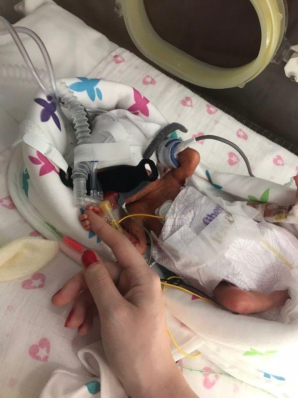 Când s-au născut, cântăreau, împreună, cât un pachet de făină. Bebelușele râd când aud de coronavirus: „A durat o oră până le-am auzit primul plânset”