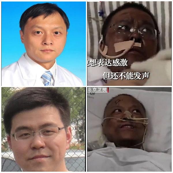 A murit unul dintre medicii a căror piele a devenit neagră în urma infecției cu noul coronavirus. Bărbatul a fost internat în spital mai bine de patru luni