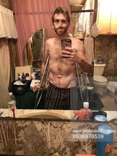 DIETA cu legume. Priviți-l! Avea 500 de kg și a slăbit peste 350 de kg mâncând! Nu a fost nici măcar o zi la sală pentru că nu a vrut. A slăbit urmând o dietă ușoară