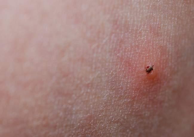 Pericol în parcuri! Mușcătura de căpușă poate fi mortală. Medicii trag un semnal de alarmă și fac mai multe recomandări