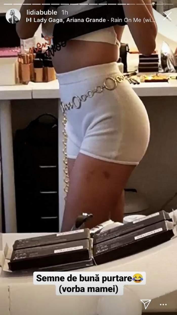 Lidia Buble, plină de vânătăi pe corp! Ce s-a întâmplat cu artista? Le-a explicat fanilor totul pe Internet