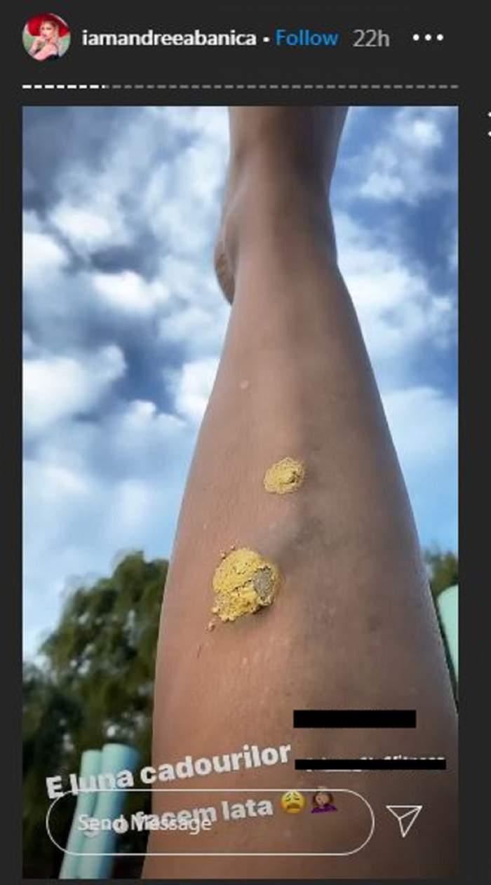 Andreea Bănică, accident grav la mare. Primele declarații: „Am crezut că mor”