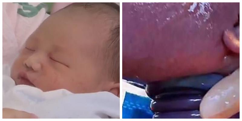 Un bebeluș s-a născut perfect sănătos, deși avea cordonul ombilical răsucit în jurul gâtului de șase ori: ”E un miracol. N-am văzut așa ceva în 23 de ani de carieră!”