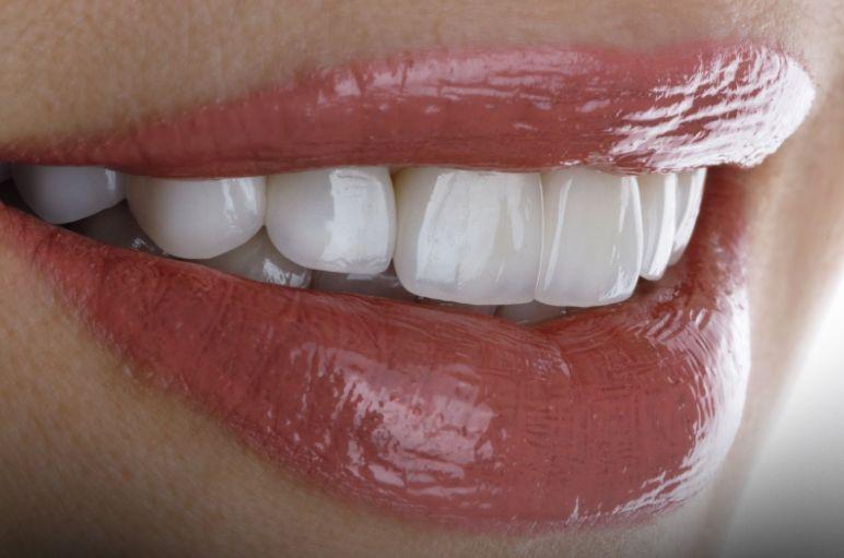 Poza pentru articolul (P) De ce un rezultat estetic reușit începe întotdeauna cu un diagnostic bun