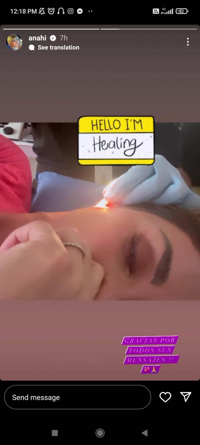 Anahi își ține mâna la nas