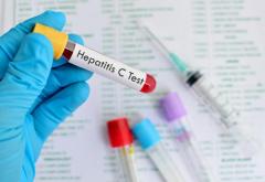 Teste gratuite pentru depistarea hepatitei C